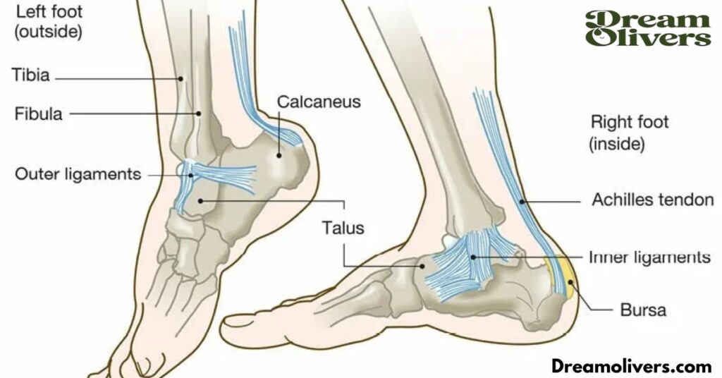 Drawing Strength from Understanding Slew Foot