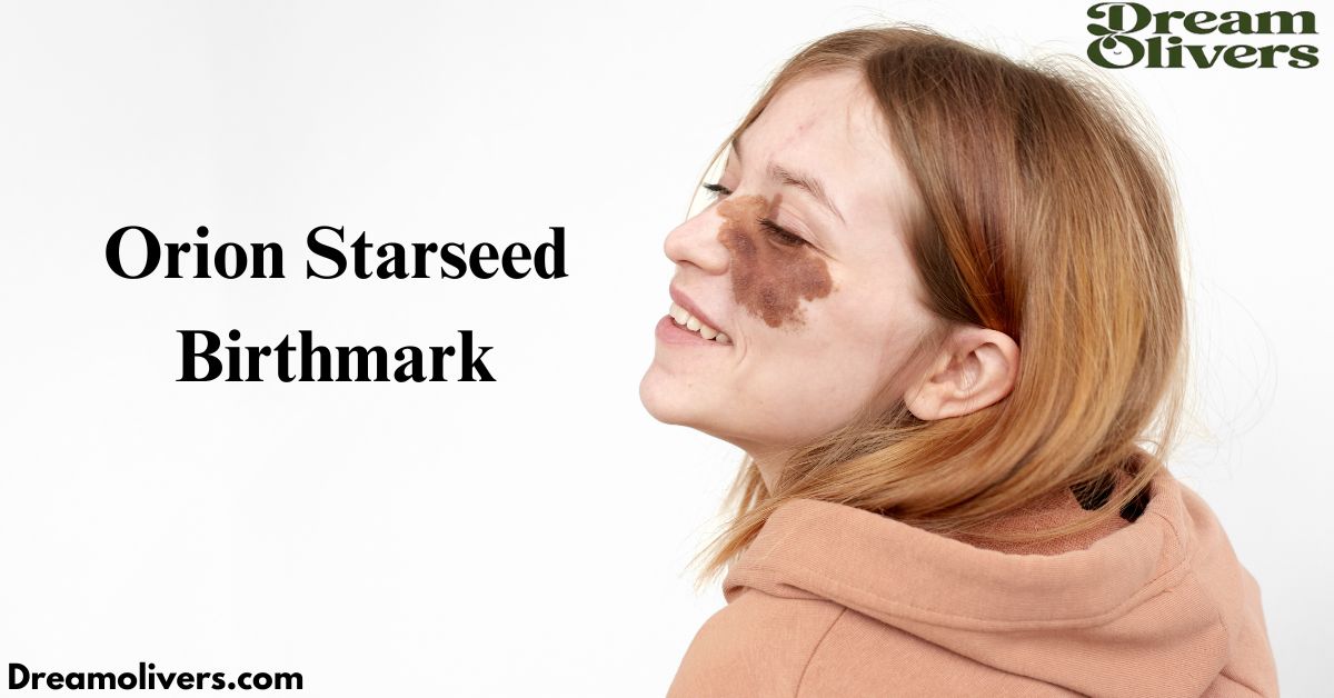 orion starseed birthmark